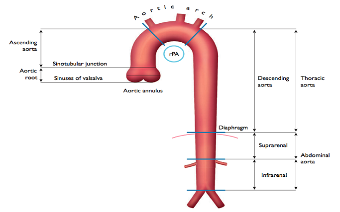 Aorta