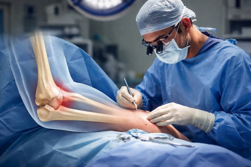chirurgo ortopedico del gomito