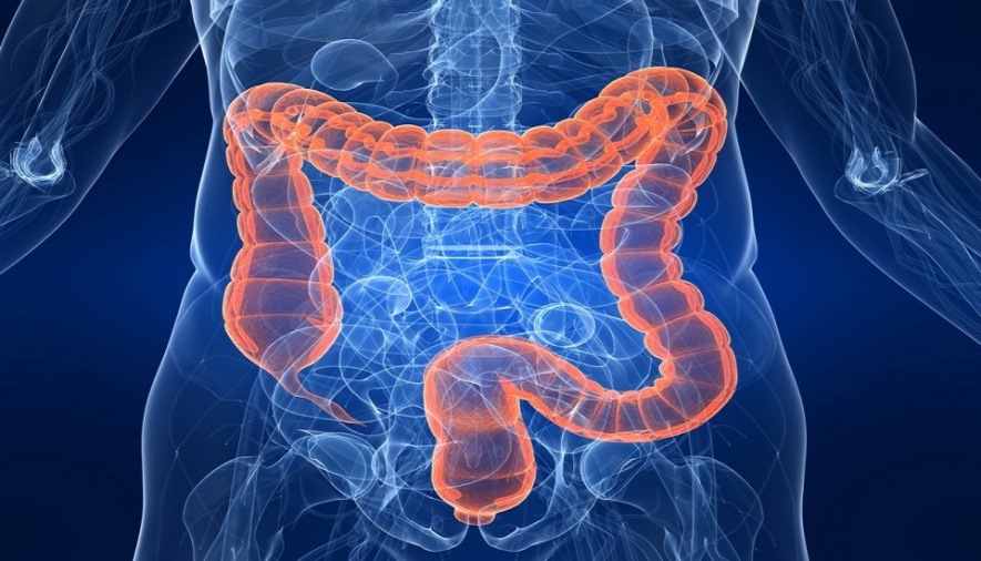 colon irritabile