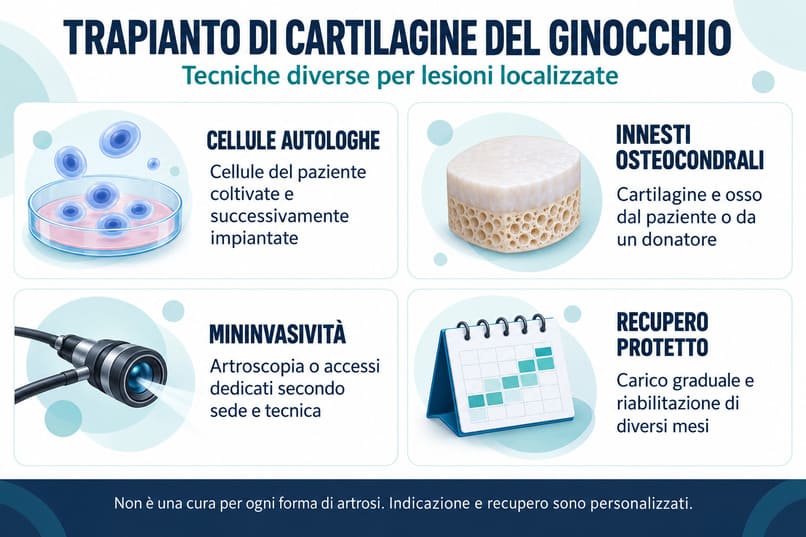 trapianto di cartilagine del ginocchio napoli ruesch dott. stefano guarino