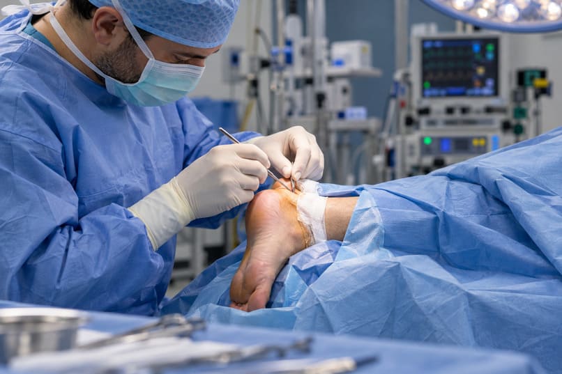 intervento chirurgico per il morbo di Haglund