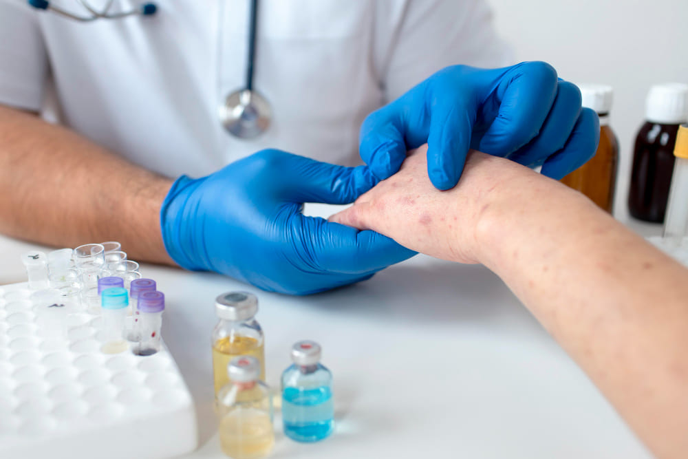 prick test