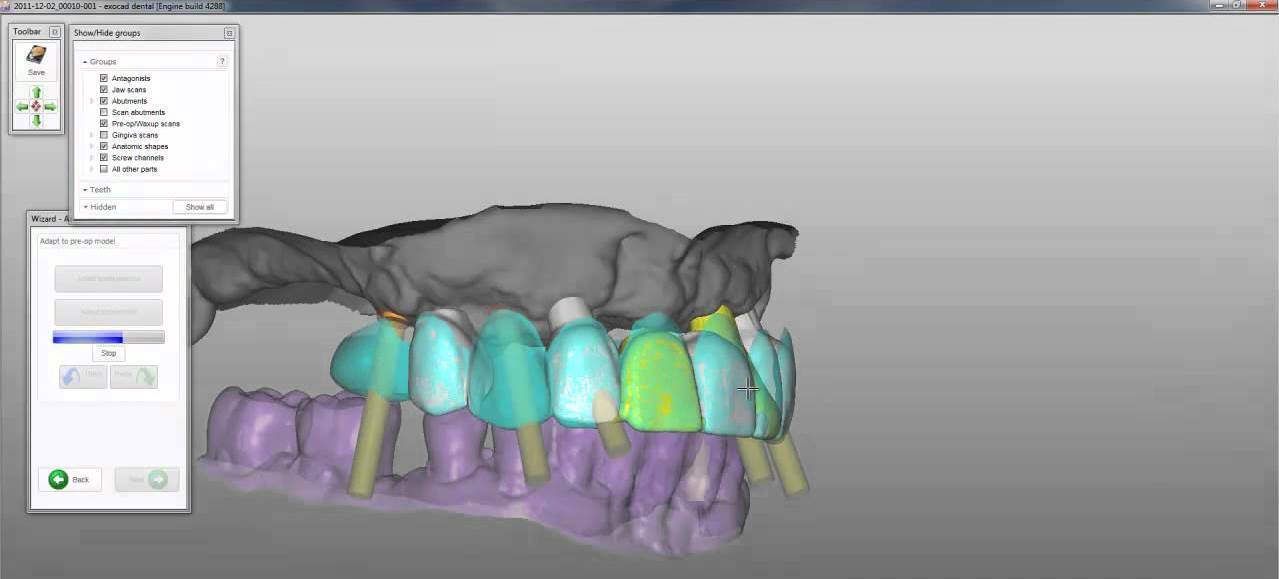 Tecnica Cad Cam